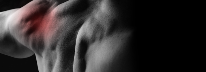 Chiropractie Zoeterwoude-Dorp EN Rotator Cuff Syndroom Chiropractie Zoeterwoude-Dorp EN Rotator Cuff Syndroom
